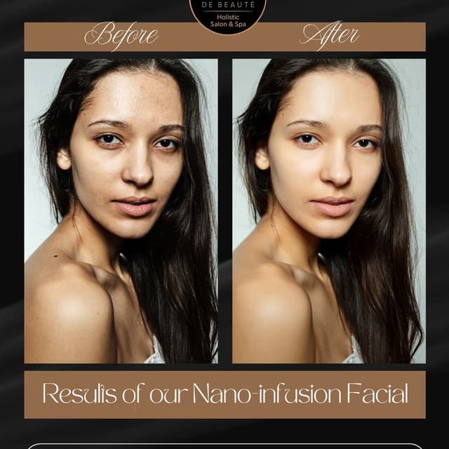 Skin rejuvenation and brightening at Saba's De Beaute in Chicago, IL